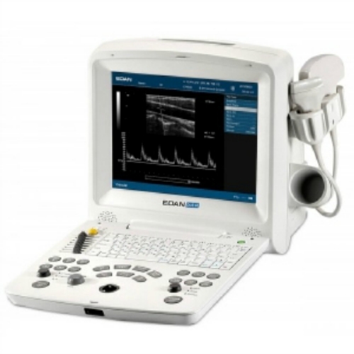 Edan Diagnostics - DUS60 Ultrasound
